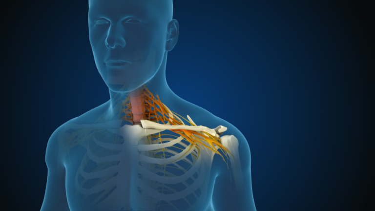 A Helpful Guide To Finding Radiculopathy Specialists