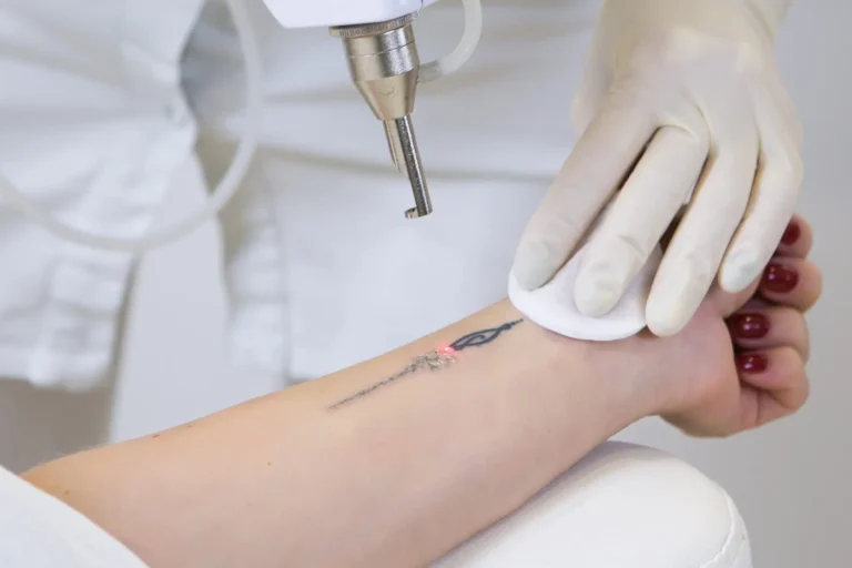 Tattoo Regret: How to Cope and Make an Informed Decision